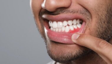 can you apply castor oil directly to gums for tooth pain