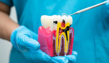 signs you may have a hidden dental infection