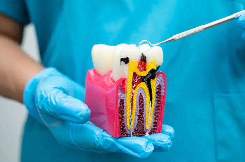 signs you may have a hidden dental infection