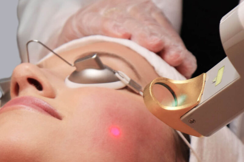 transform your skin with laser genesis the ultimate hydrating facial experience