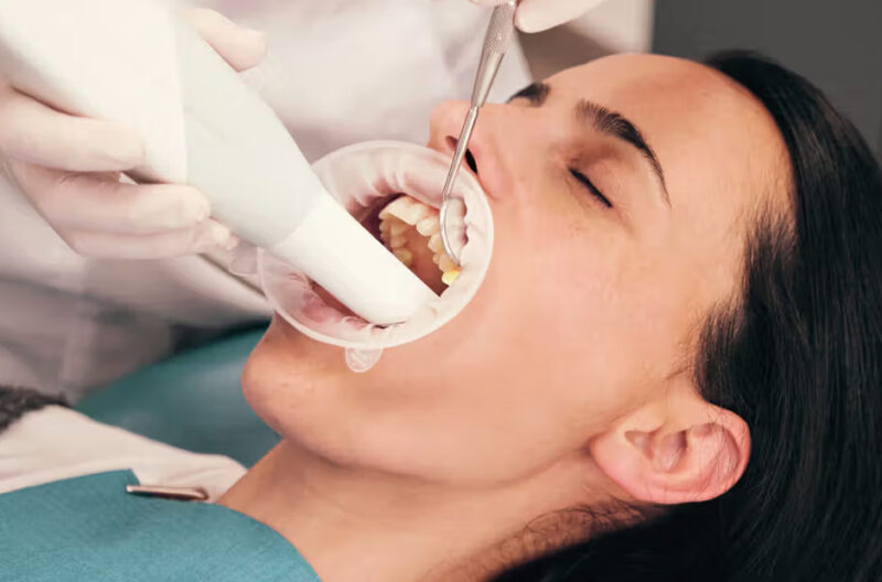 what happens during a deep teeth cleaning