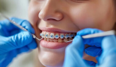 orthodontic treatment for young adults
