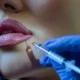 exploring lip filler procedures in marin county for beauty aficionados 1